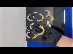 Ti-Bar Zirconia Hybrid Bridge