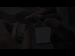 Grassshopper Veneers The Perfect Solution For Natural Translucency Dental Veneers