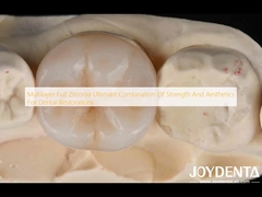 Multilayer Full Zirconia Ultimate Combination Of Strength And Aesthetics For Dental Restorations