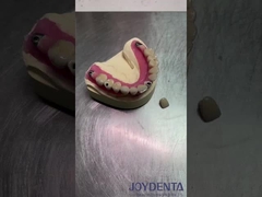 Dental Biomimetic Aesthetic Diagnostic  Wax-Up Of Veneers