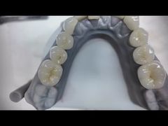 Zirconia dentures that imitate natural teeth
