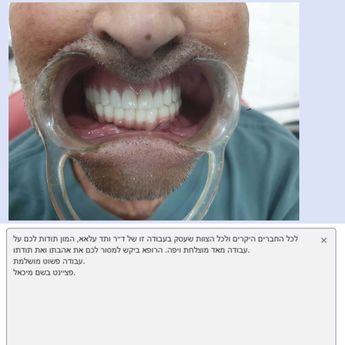 Latest company blogs about Joydentalab Denture Processing Factory: Winning Patients' sincere praise with quality