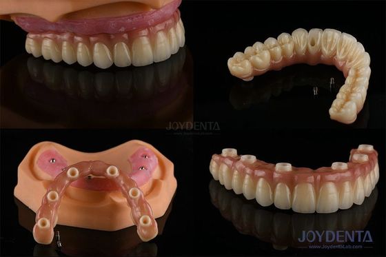 Buy Dental Multiple Teeth Replacement Implants Rough Surface Prosthetic Components online manufacture