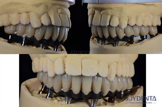 Buy Titanium Multiple Teeth Dental Implant Prosthetic Surgery External Hexagon Connection online manufacture