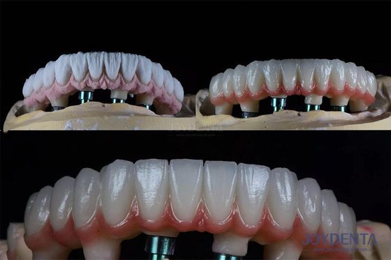 Buy 10mm Multiple Teeth Two Stage Dental Implant Kit For Endosseous Prosthetic Crown online manufacture