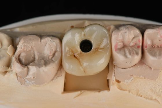Buy titanium 10mm Single Tooth Dental Implants Replacement Abutment Self Tapping Sandblasted online manufacture