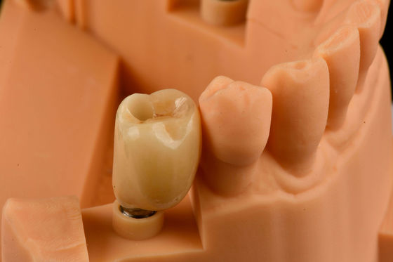 Buy Internal Hex Connection Sandblasted Titanium Dental Implants Single Tooth Replacement online manufacture