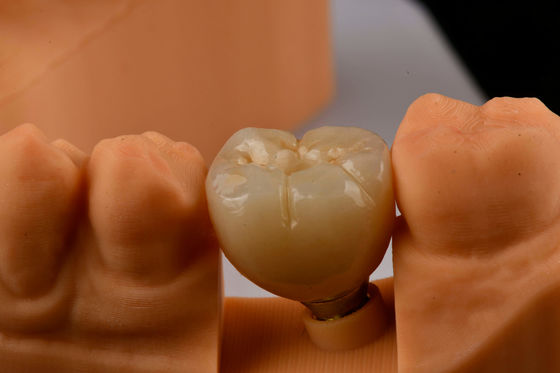 Buy Oral Implantology Self Tapping Single Tooth Dental Implants With Internal Hex Connection online manufacture