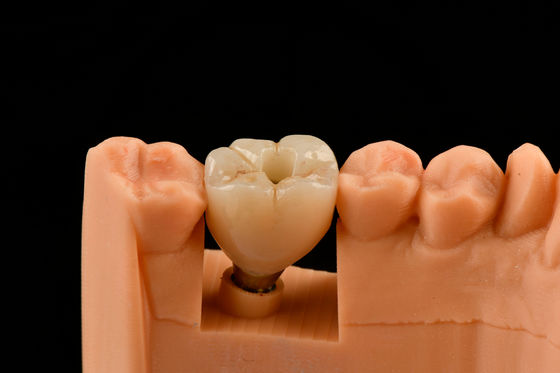 Buy 10mm Titanium Tooth Implant Sandblasted Self Tapping Dental Implants online manufacture