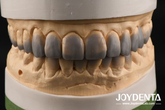 Buy Natural Color Dental Wax Up Versatile Solution for Single or Multiple Teeth Restoration online manufacture