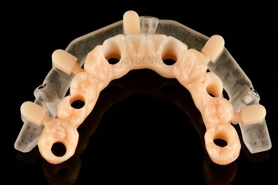 Buy Custom Precision 3D Printed Guided Surgery Templates For Accurate Implant Placement online manufacture