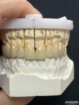Buy Seamless PFM Porcelain Fused Metal Crown For Long Term Biocompatible Restoration online manufacture