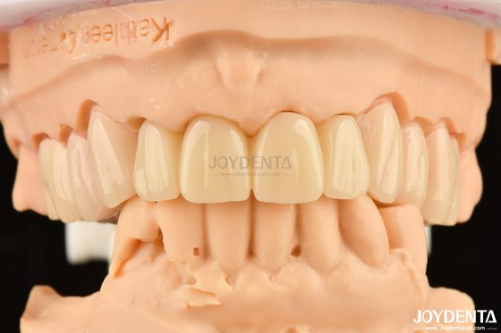 Buy Biocompatible PMMA M75 Restoration Scratch Resistant For Dental Aesthetics online manufacture