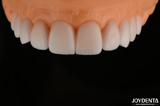 Buy Smooth Replicated Diagnostic Wax Up FDA , Full Arch Teeth Wax Up Highly Accurate online manufacture