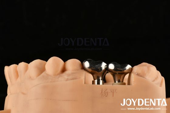 Buy Silver Dental Implant Abutments Customizable Diameter Height CAD CAM Technology online manufacture