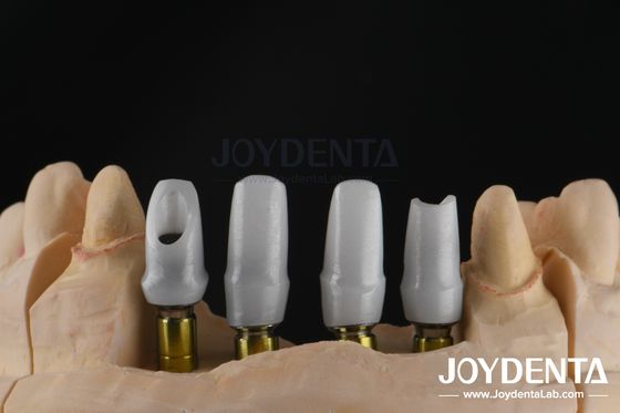Buy Custom Dental Implant Zirconia Abutment For Single Or Multiple Unit Restorations online manufacture