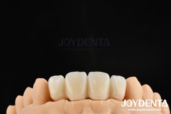 Buy Biologically Oriented Preparation Technique BOPT For Accurate Dental Preparation online manufacture