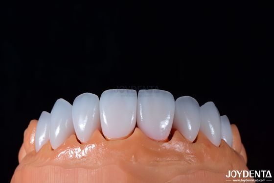 Buy 0.3-0.5mm Thickness Emax Porcelain Veneer for High Gloss Cosmetic Dentistry online manufacture