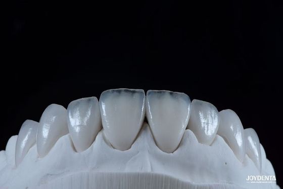 Buy Natural Looking Emax Porcelain Veneer Comfortable Fit Ultra Thin Emax Veneers online manufacture