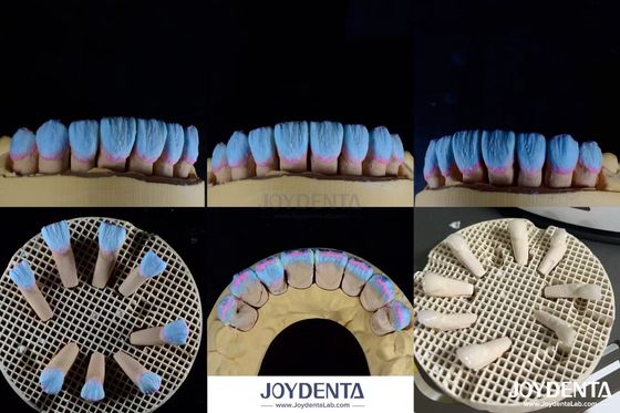 Buy High Biocompatibility Feldspathic Ceramic Veneer Glossy For Dental Restorations online manufacture