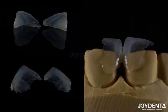 Buy Minimally Invasive Cosmetic Dental Veneers Glass Ceramic Color ultra thin online manufacture