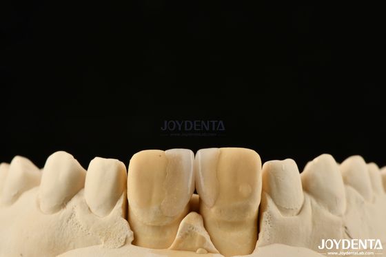 Buy 0.2mm Thickness Microthin Veneers Glass Ceramic Dental Veneers For Front Teeth online manufacture