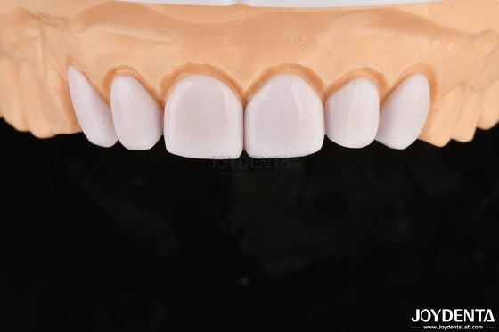 Buy Glossy Or Matte Surface Glass Ceramic Dental Veneers For Teeth Whitening online manufacture