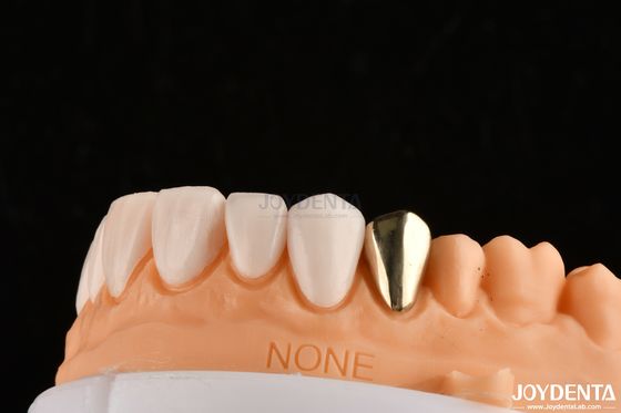 Buy Ultra Thin IPS Emax Press Veneers Cosmetic Teeth Veneers For Anterior Posterior Restorations online manufacture