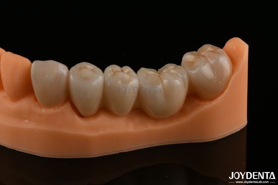 Buy Precision Dental Restorations Full Zirconia High Flexural Strength Natural Color online manufacture