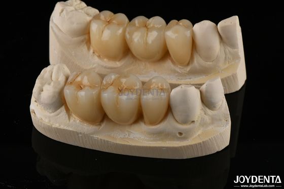 Buy Wear Resistant Zirconia Full Contour Dental Crown High Translucency online manufacture
