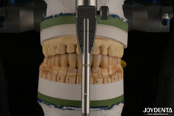 Buy High Aesthetics Porcelain Layered Dental Zirconia For Implant Restorations online manufacture