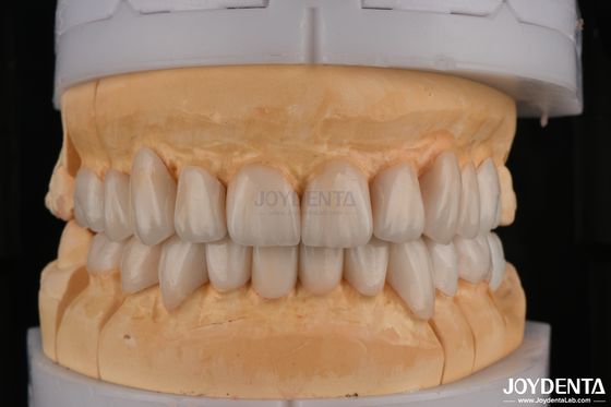 Buy High Translucency Layered Zirconia For Full Contour Dental Restorations online manufacture