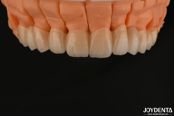 Buy High Aesthetics Layered Zirconia Single Crowns Bridges Implant for Dental Restorations online manufacture