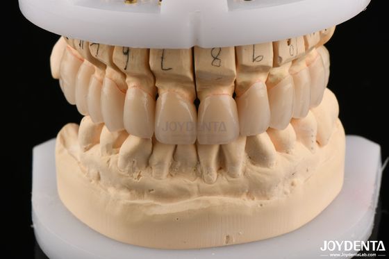 Buy Polished Surface Flexural Strength Layered Zirconia for Bridges 6.0-6.1 G/cm3 Density online manufacture