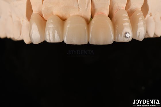 Buy CAD / CAM Milling Dental Layered Zirconia For Single Crowns 0.3-0.5mm Layer Thickness online manufacture