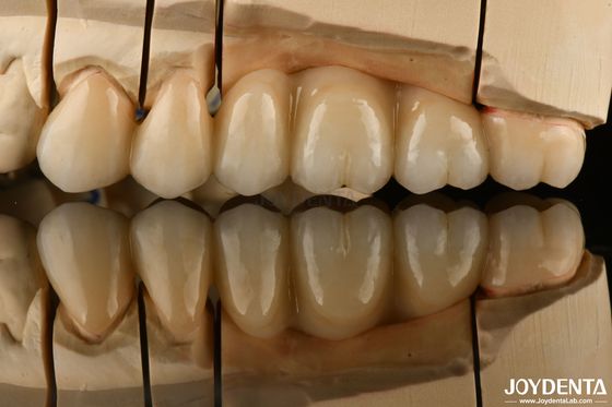 Buy Natural Looking Multilayer Full Zirconia For Dental Restorations Ultra Translucent online manufacture