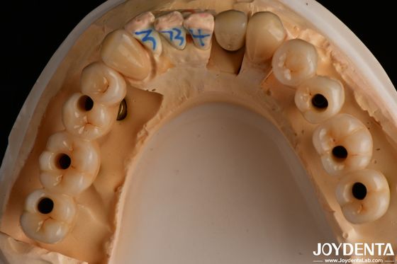 Buy High Translucency Multilayered Full Contour Zirconia Natural looking 1200 HV online manufacture