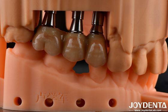 Buy High Flexural Strength Multilayer Full Zirconia Dental Solution Full Arch Restorations online manufacture