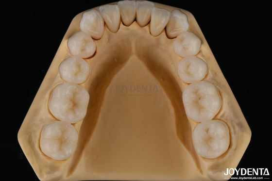 Buy 3D Multi Layer Dental Full Zirconia Chipping Resistance Natural Tooth Structure online manufacture