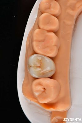 Buy Dental Multilayer Full Zirconia Crowns And Bridges High Translucent Natural Looking online manufacture