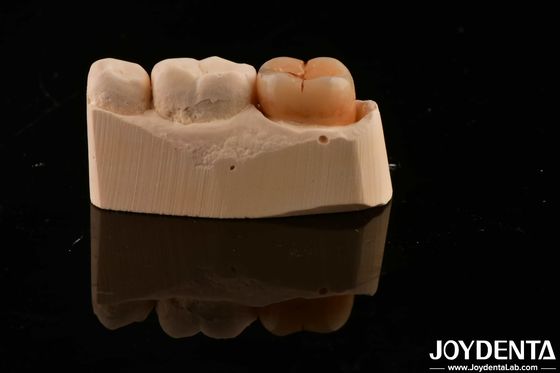 Buy Dental Restoration Material Multilayer Full Zirconia 1200 HV Hardness Crack Resistance online manufacture