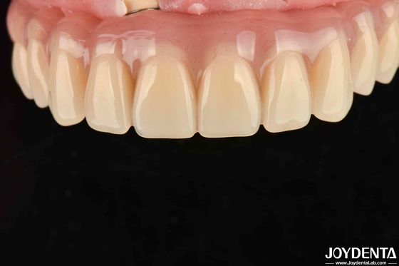 Buy Fast Drying 5 Minutes Acrylic Teeth Finish For Dental Tooth Restoration online manufacture