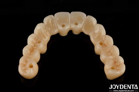 Buy High Flexibility Zirconia Hybrid Bridge With Titanium Base High Aesthetic online manufacture