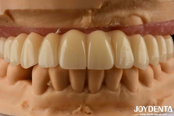 Buy Dental Solution Ti-Base Zirconia Hybrid Bridge High Biocompatibility Natural Looking online manufacture