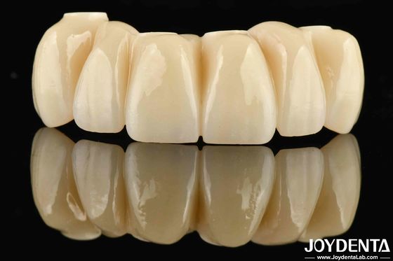 Buy Dental Restoration Ti-Base Zirconia Hybrid Bridge Natural Looking Precise Fit online manufacture