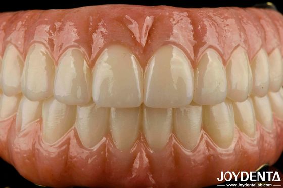 Buy Precise Fit Dental Ti-Bar Zirconia Hybrid Bridge Replacement For Missing Teeth online manufacture