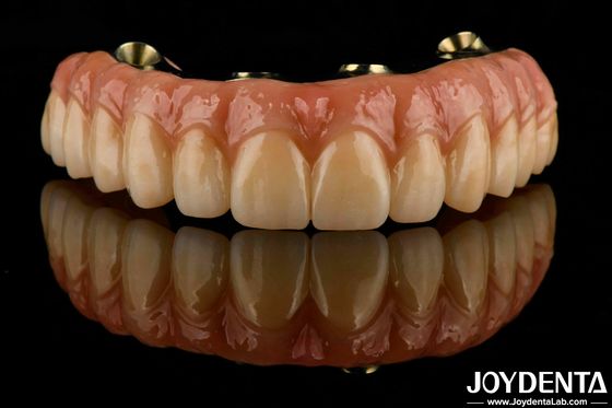 Buy Dental Ti-Bar Hybrid Zirconia Bridge Excellent Strength Restores Chewing Function online manufacture