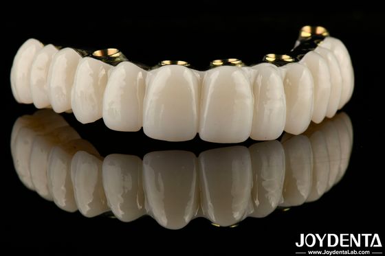 Buy Smooth Hybrid Zirconia Implant Bridge Restoring Chewing Function Custom Made online manufacture