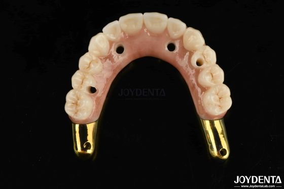 Buy Wear Resistance Zirconia Hybrid Bridge With Ti-Bar Compatible Natural Teeth And Gums online manufacture