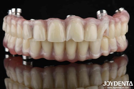 Buy Natural Look Dental Laboratory Acrylic Teeth Finish For High Wear Resistance online manufacture